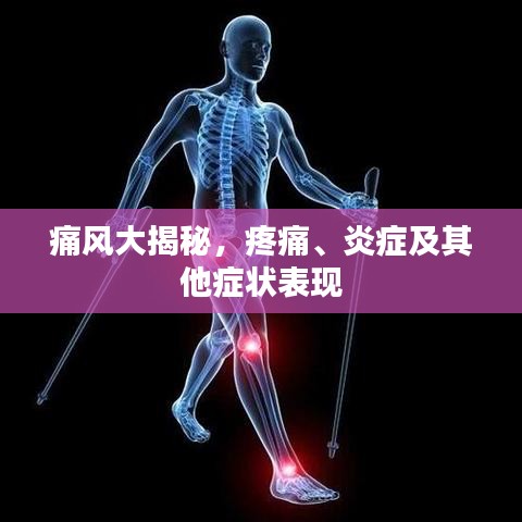 痛风大揭秘，疼痛、炎症及其他症状表现